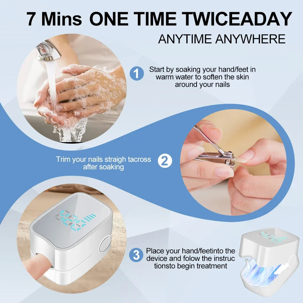 Nail Treatment Device for Fungal Infection,Nail Fungus Laser Assist Tool UV Professional Nail Fungus Blue Cleaning Laser Device