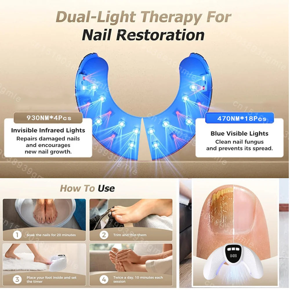 Nail Fungal Light Device Fungal Discolored Remover Portable Nail Fungal Eradication Device for Thick Toenails and Fingernails
