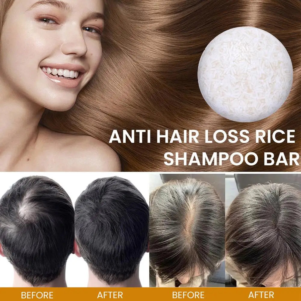 Rice Shampoo Bar Natural Organic Rice Soap for Hair Growth Deep Cleansing Solid Shampoo and Conditioner Bar Oil Control