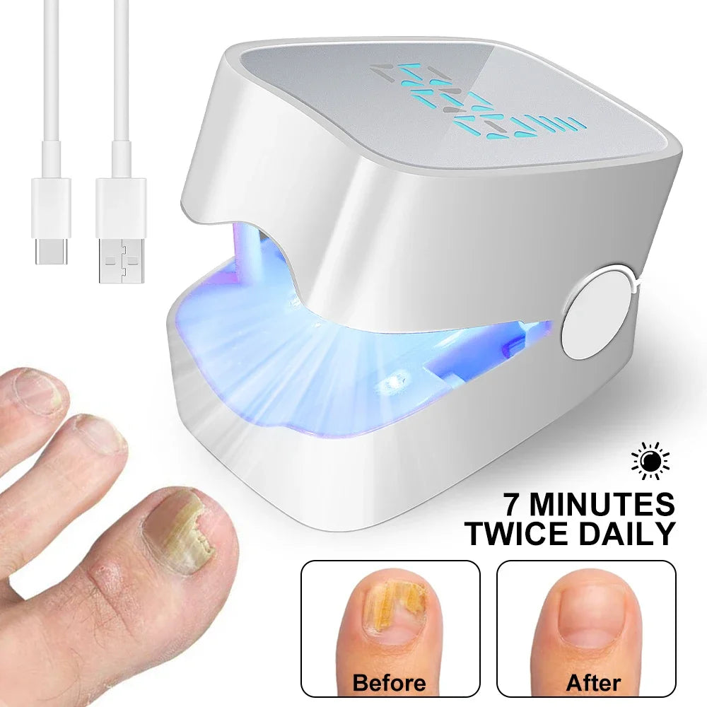 Nail Treatment Device for Fungal Infection,Nail Fungus Laser Assist Tool UV Professional Nail Fungus Blue Cleaning Laser Device