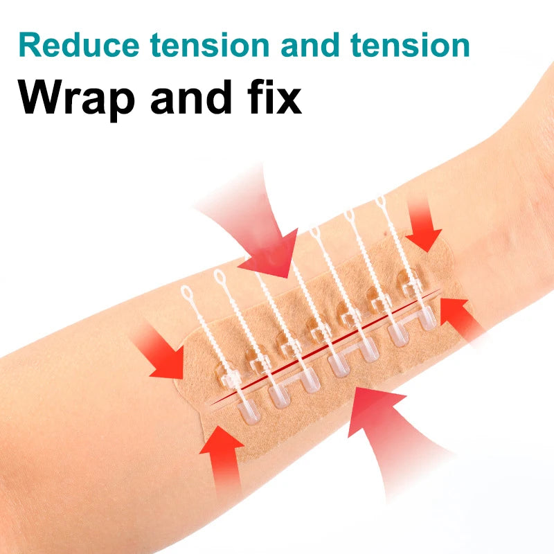 1pcs Zipper Tie Wound Closure Patch Hemostatic Patch Wound Fast Suture Zipper Band-Aid Outdoor Portable