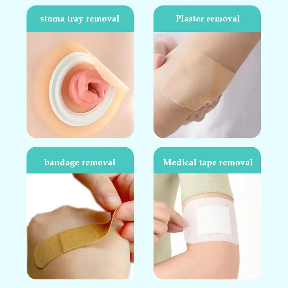 1/2/3/5Pcs Colostomy Adhesive Wipe-Off Spray Medical Adhesive Remover Ostomy Bag Care Clean And Disinfect Skin Supplies