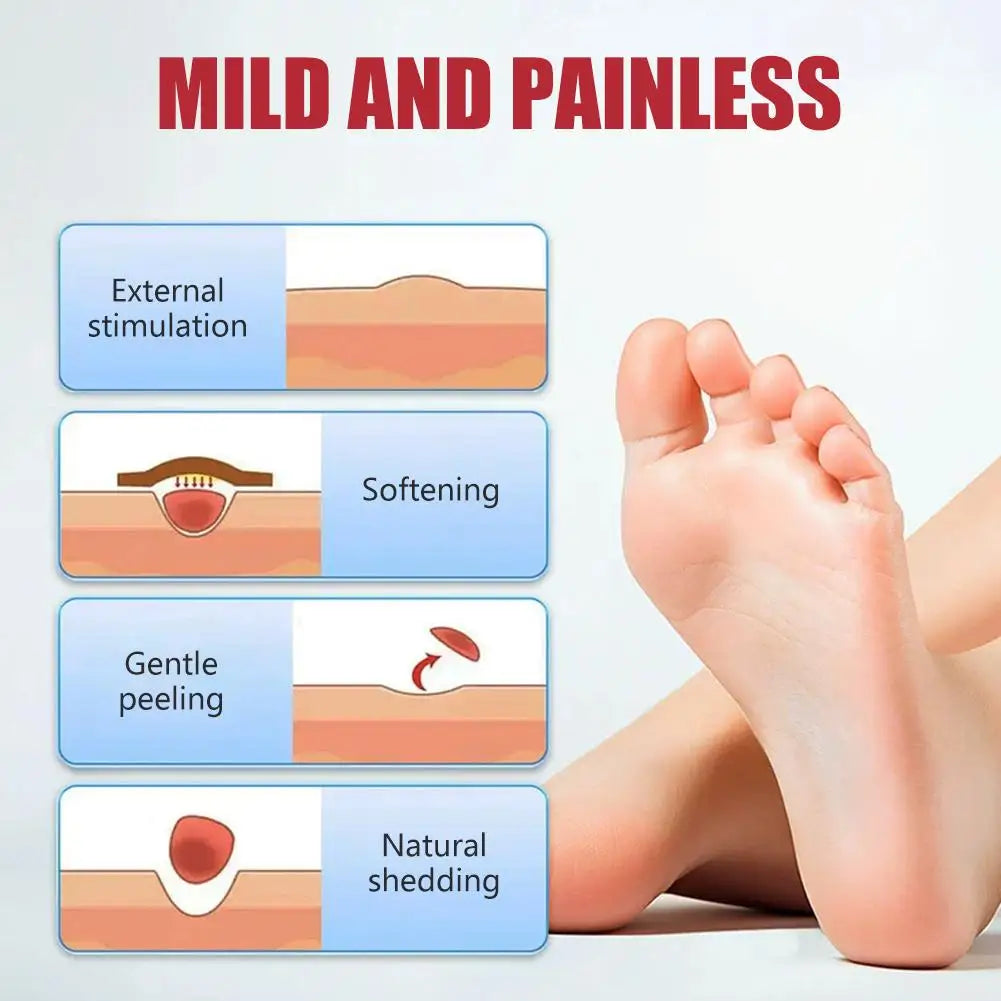 10Pcs Corn Remover Pads for Feet Foot Care Plaster Remove Callus Dead Skin Thorn Treatment Patch