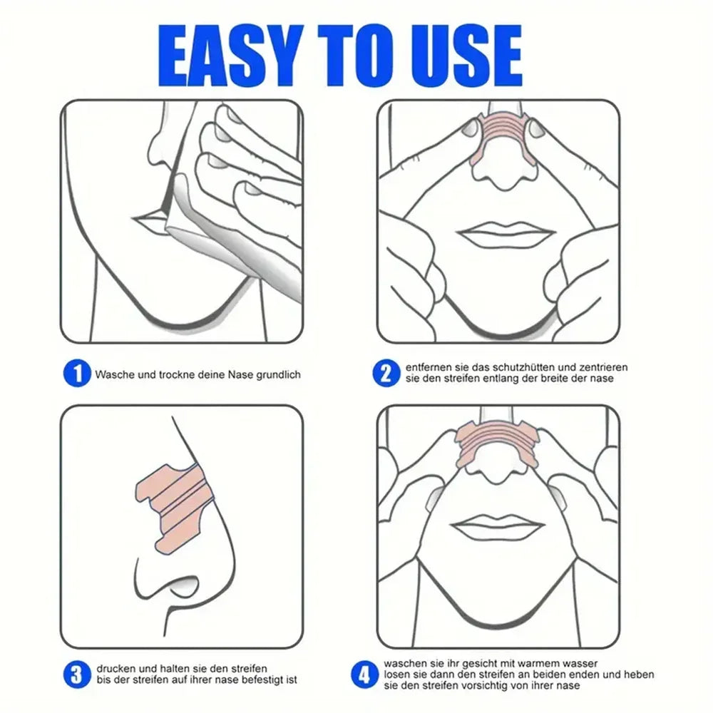 20-100pcs Snoring Stickers Breathing Nose Strips Physical Airway Expansion for Improved Nose Vent Anti-Snoring Comfort Sleep Aid