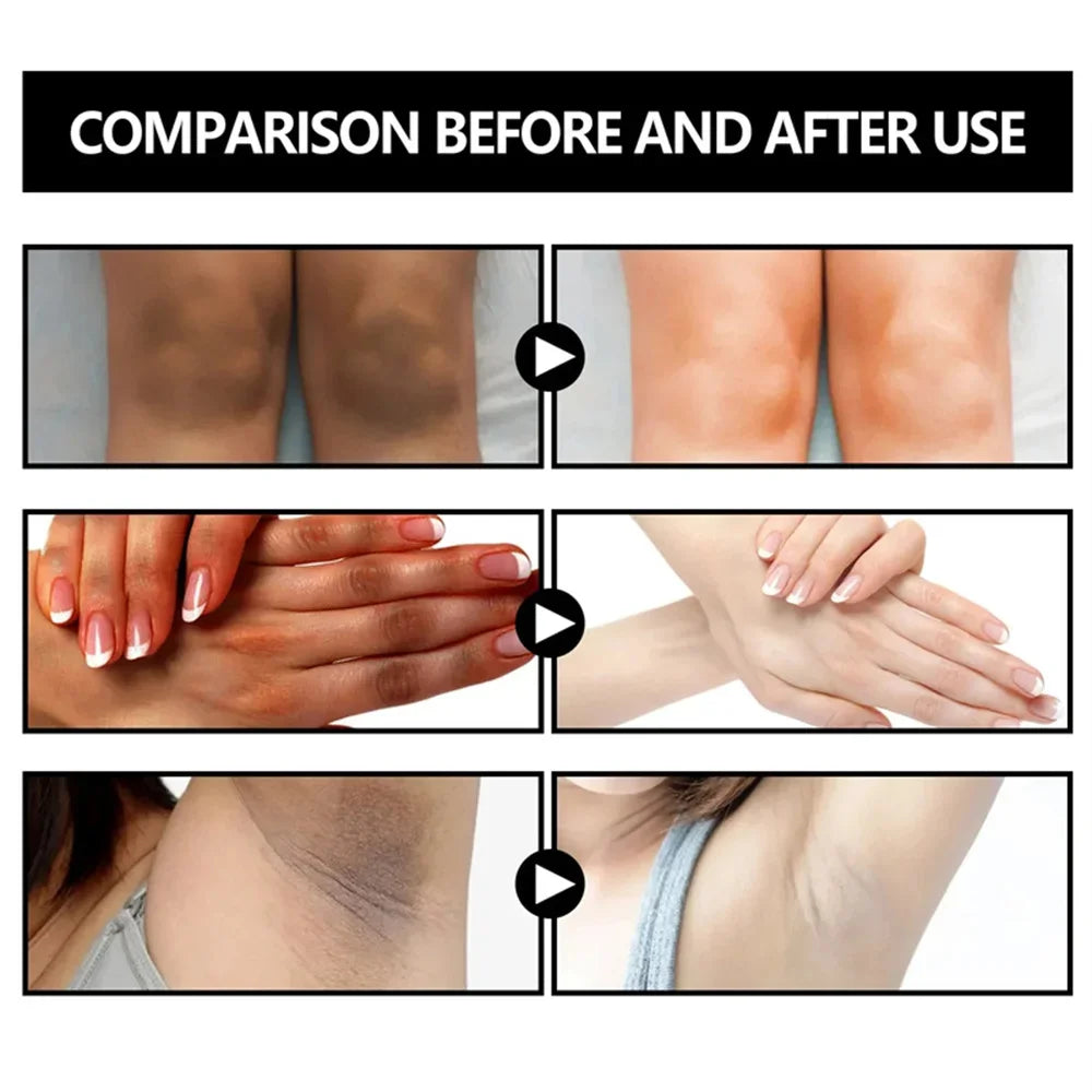 Body Whitening Soap Underarm Knee Bleaching Soap Chicken Skin Removal Dark Spot Removal Dead Skin Moisturize Brighten Body Care