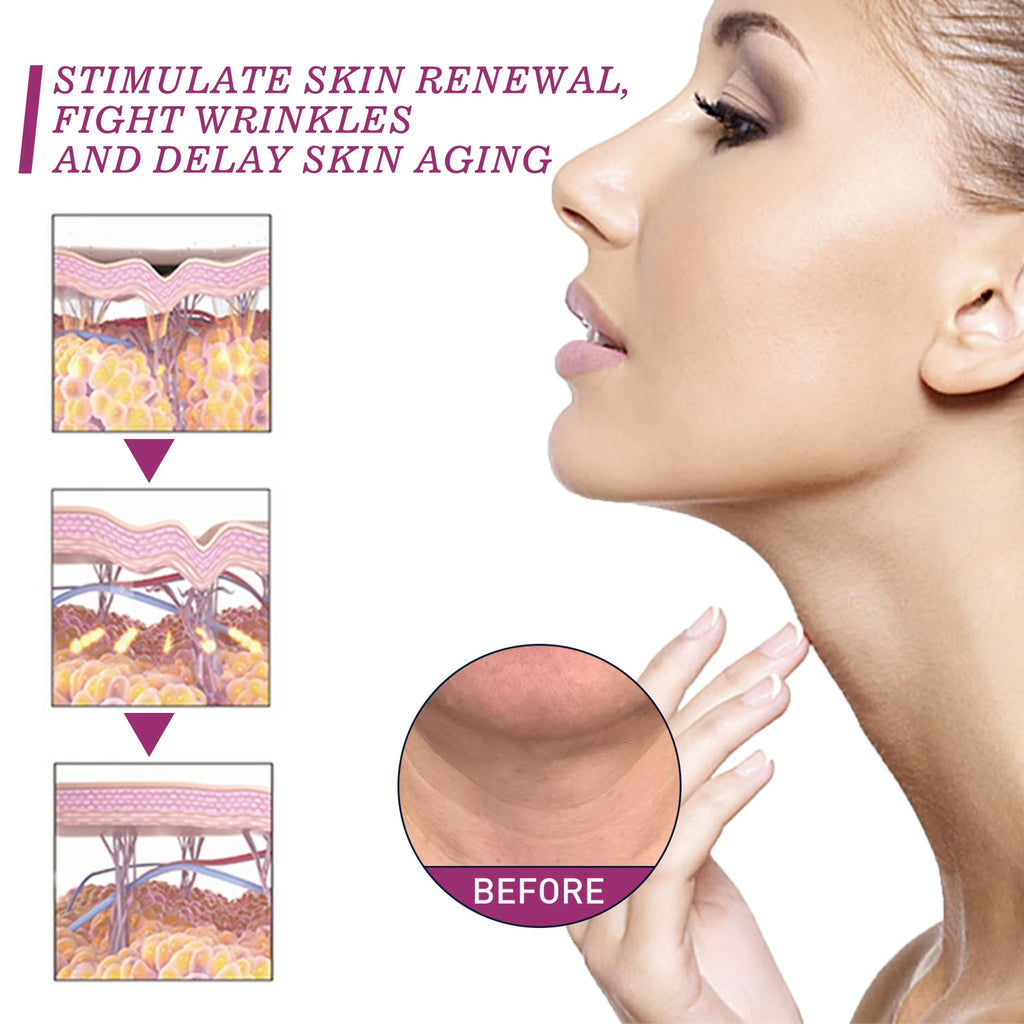 Hydrolyzed Collagen Neck Cream Eliminate Neck Fine Lines Firming Lifting Neck Remove Double Chin Rejuvenation Cream SkinCare