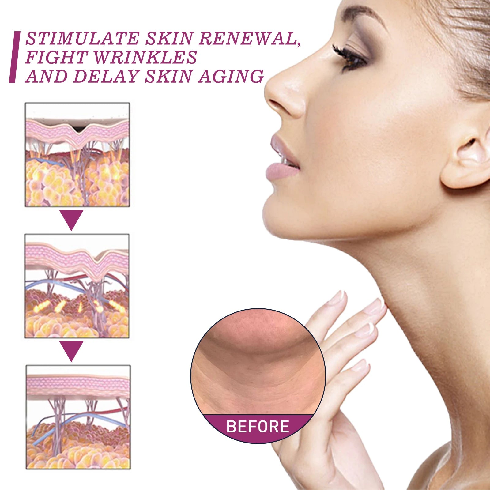Hydrolyzed Collagen Neck Cream Eliminate Neck Fine Lines Firming Lifting Neck Remove Double Chin Rejuvenation Cream SkinCare