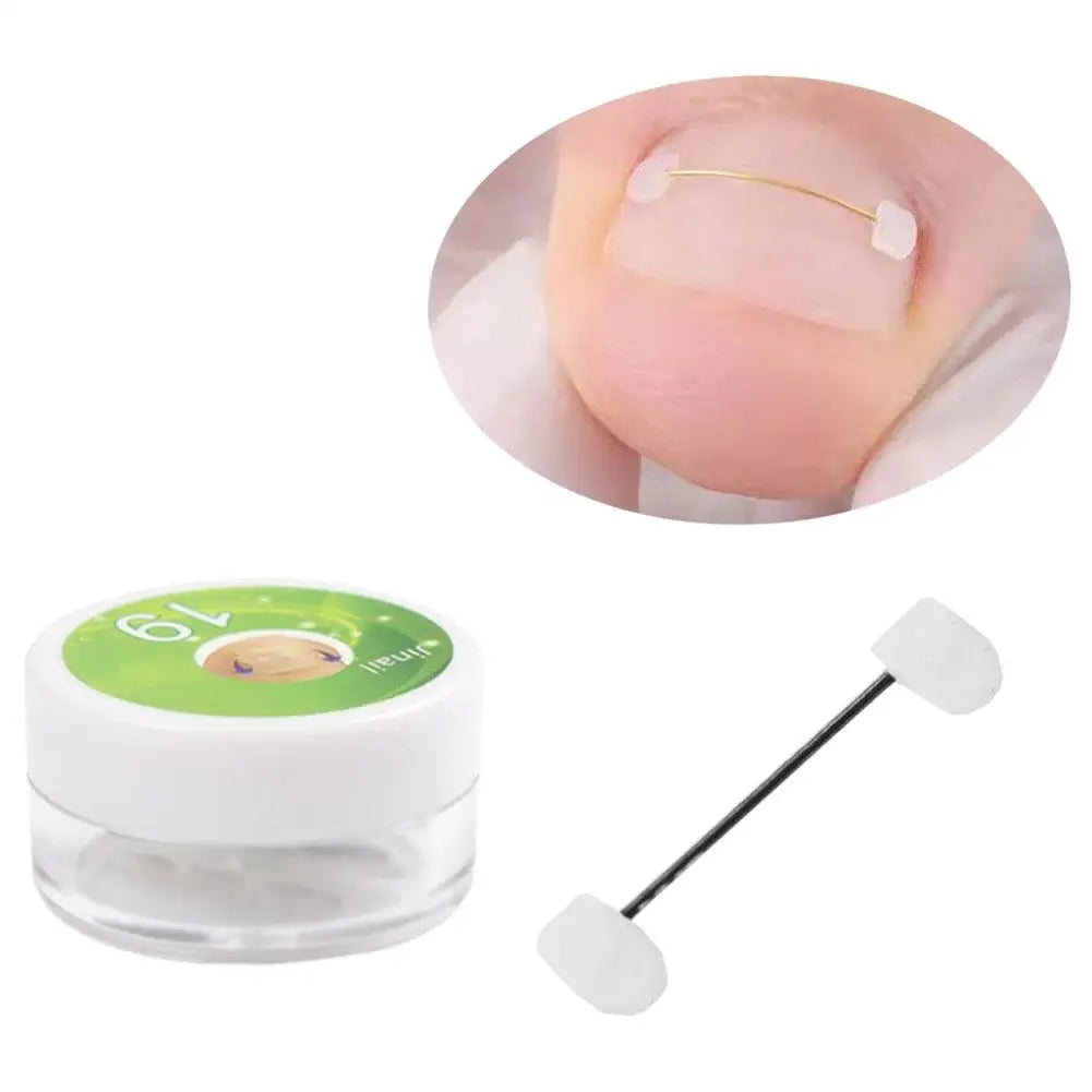 Titanium Alloy Toenail Corrector Orthopedic Sticker Memory Wire For Ingrown Nail Treatment Hallux Valgus Care Kit Ingrown Nail