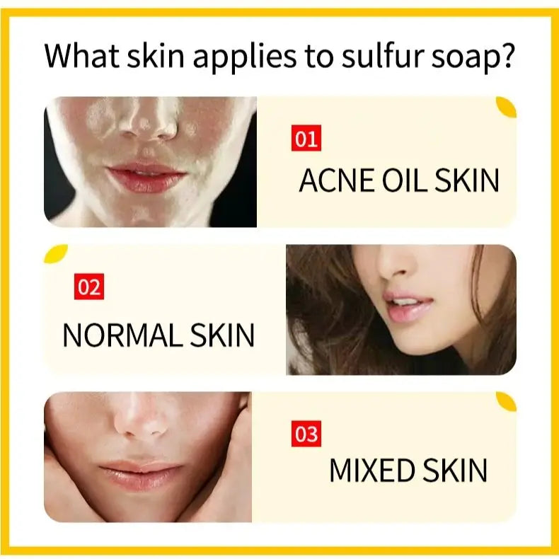 20/30Pc Zudaifu Skin Beauty Soap 7g Cleanser Moisturizing Soothing Oil-control Hand Body Cleansing Removing Mites Soap