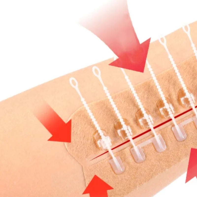 1pcs Zipper Tie Wound Closure Patch Hemostatic Patch Wound Fast Suture Zipper Band-Aid Outdoor Portable