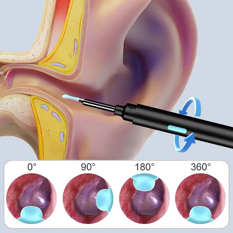 Visual Ear Cleaner Video Ear Camera 4.2mm Ear Picking WIFI Ear Endoscope With 6LEDs Digital Ear Wax Removal Tool Ear Spoon Kit