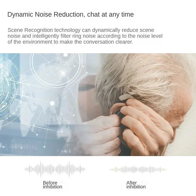 Oticon Jet 2 BTE Bluetooth Tinnitus masking Hearing Aids For the Deafness,48 Channel Original Programmable Digital Hearing Aid