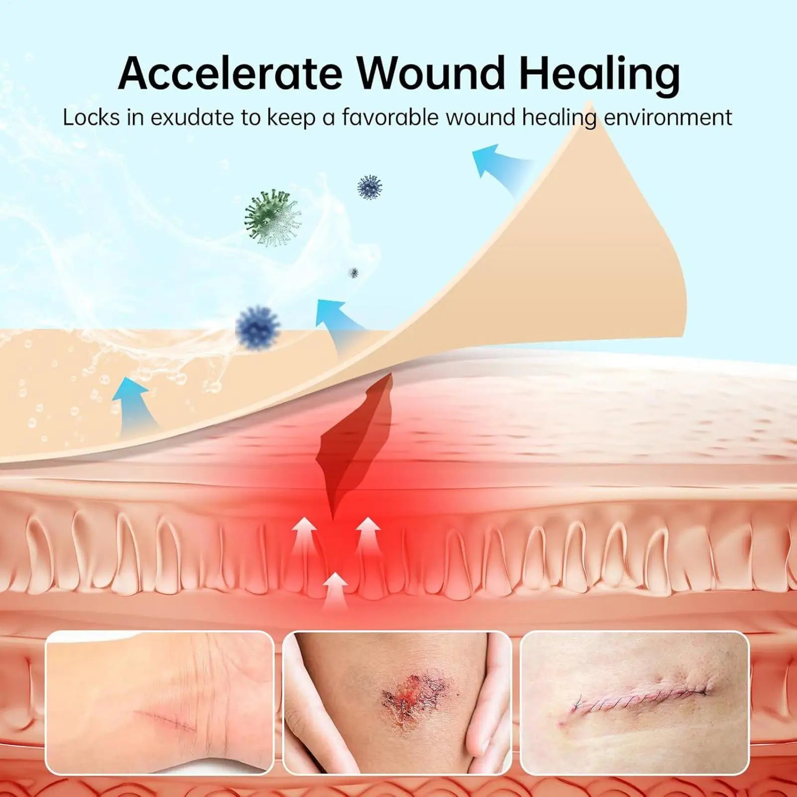 Hydrocolloid Roll Waterproof Pimple Patches Absorbent Flexible Tape Adhesive Dressing for Blister Burn Pimple Skin Heel Daily