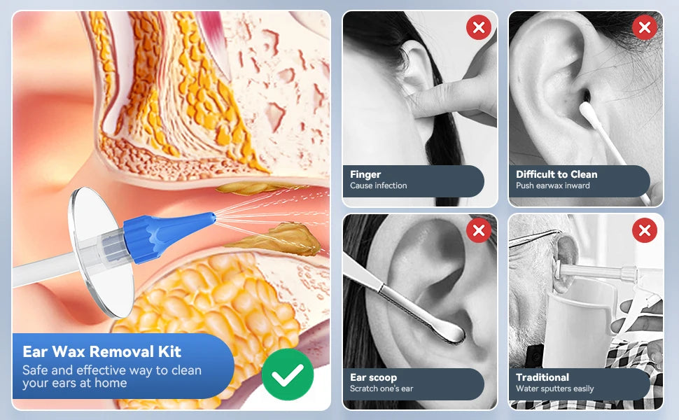 Ear Wax Removal Manual Ear Cleaner Water Cleaner Earwax Remover Kit Ear Irrigation Flushing System Ear Cleaning Kit Healthy Care