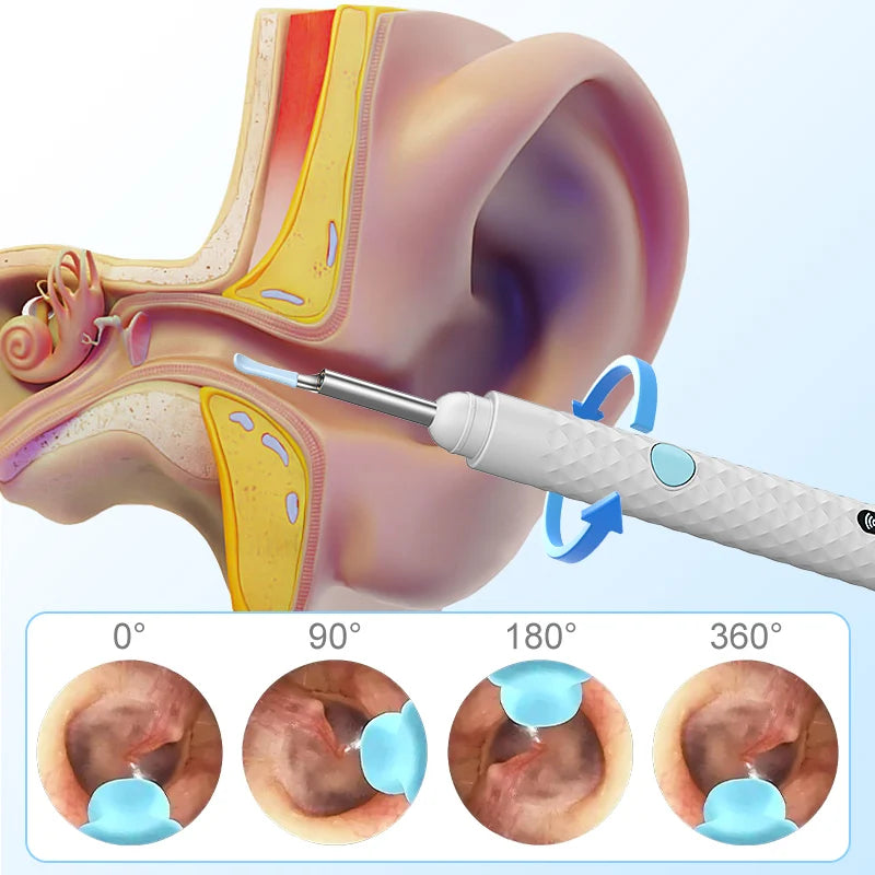 4.2mm Camera Viual WiFi Endoscope 1080P Camera for iOS/Android Phones Tablet Waterproof Ear Scope for Ear Cleaning Skin Check