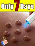 Enable you to have perfect skin and effectively remove skin blemishes