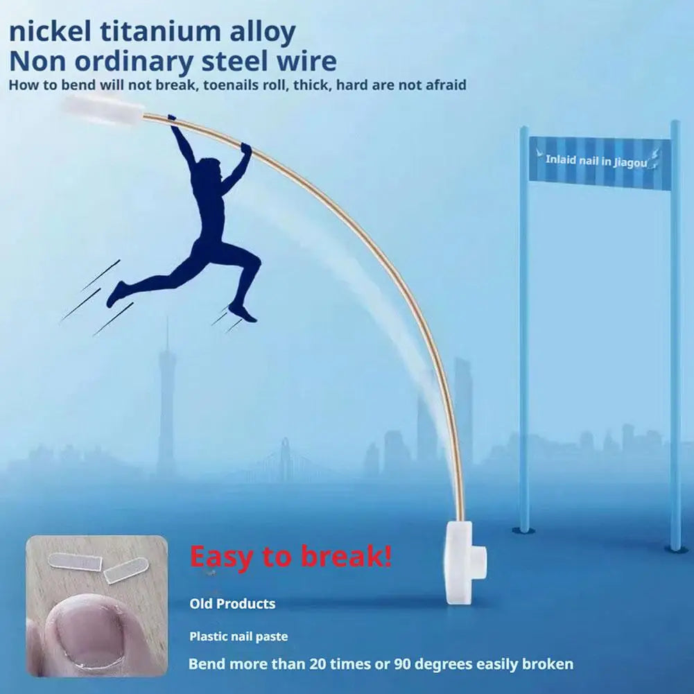 Titanium Alloy Toenail Corrector Orthopedic Sticker Memory Wire For Ingrown Nail Treatment Hallux Valgus Care Kit Ingrown Nail