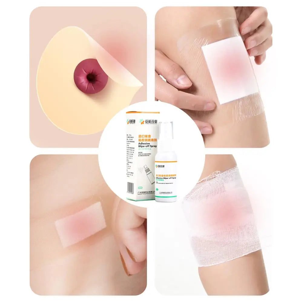 1/2/3/5Pcs Colostomy Adhesive Wipe-Off Spray Medical Adhesive Remover Ostomy Bag Care Clean And Disinfect Skin Supplies